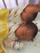 X女士甲状腺切除患者试管成功妊娠